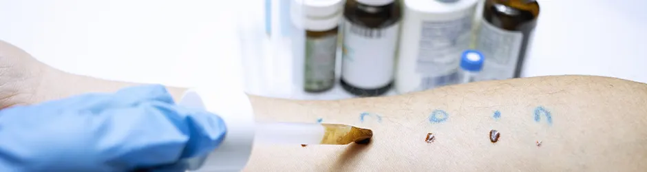 Этапы лечения и наблюдения за аллергией